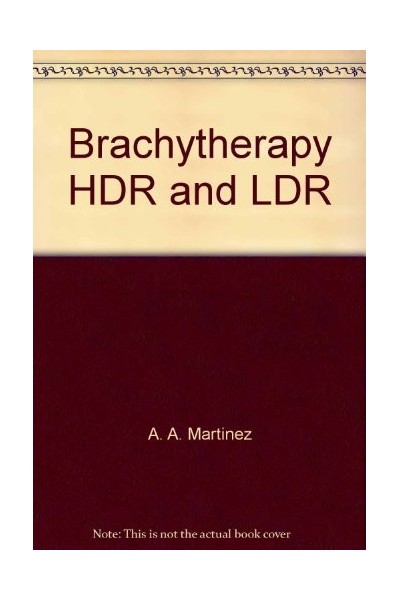 Brachytherapy HDR and LDR